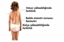 Bebeklerde Omurga Eğriliği Belirtileri ve Tedavisi